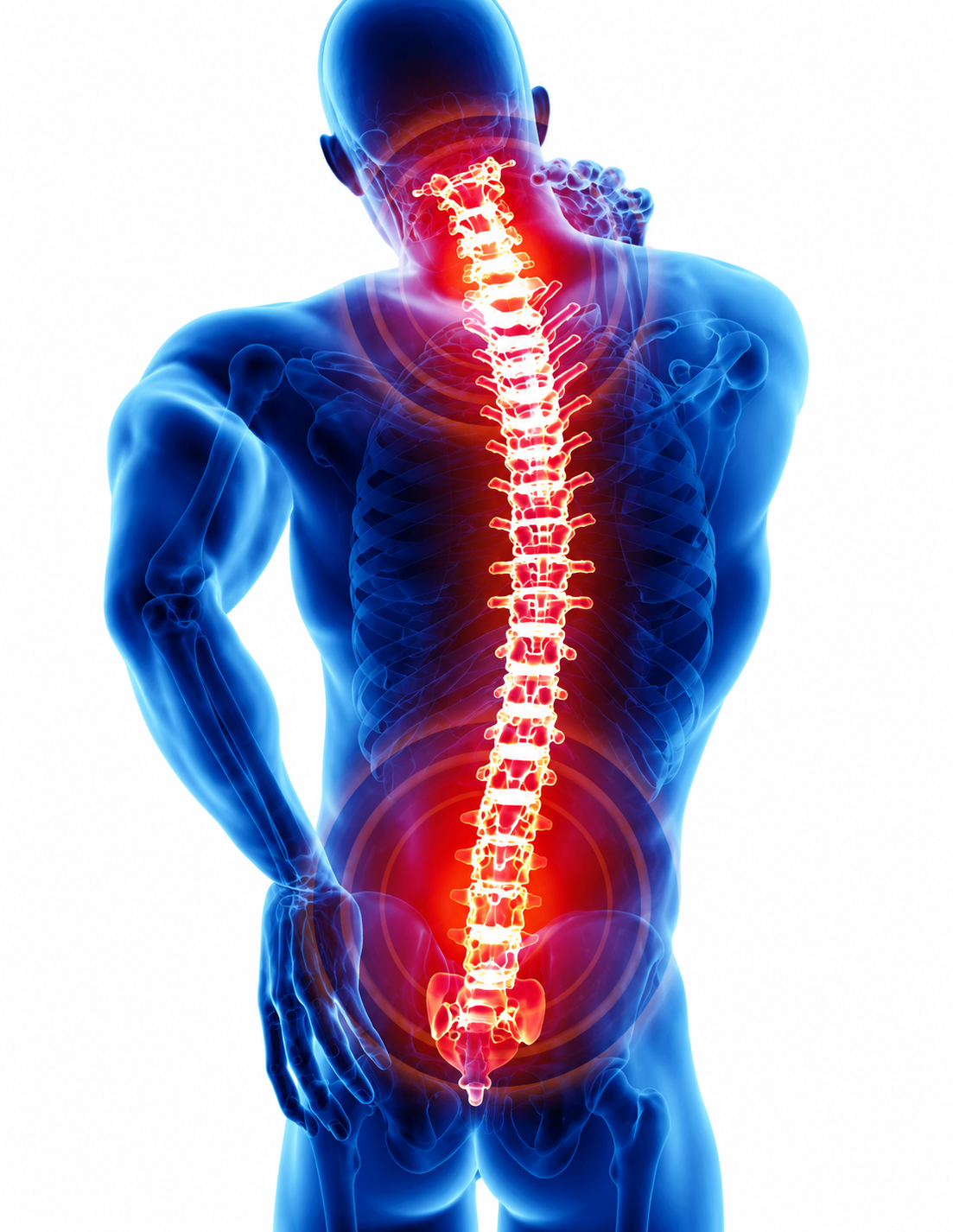 Neck and Back Pain