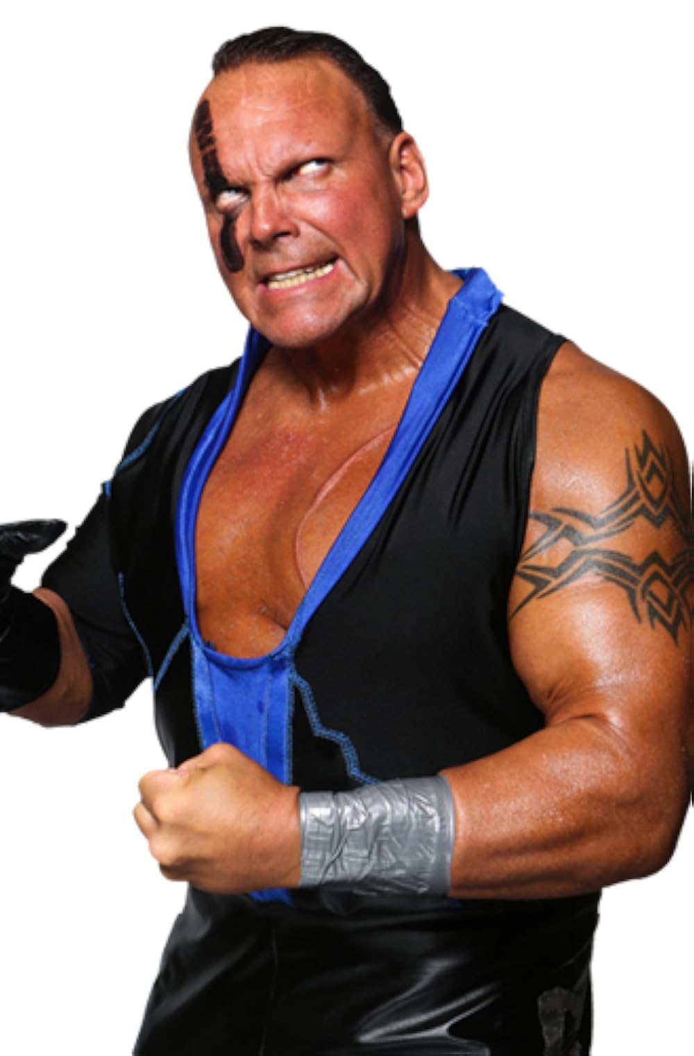 Indie Veteran PCO Undergoes Life-Threatening Neck Surgery After Triple Fracture