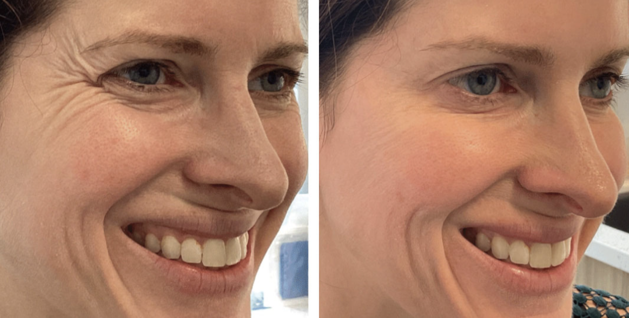 Before and after treatment