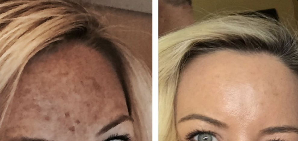 Medical-grade skincare