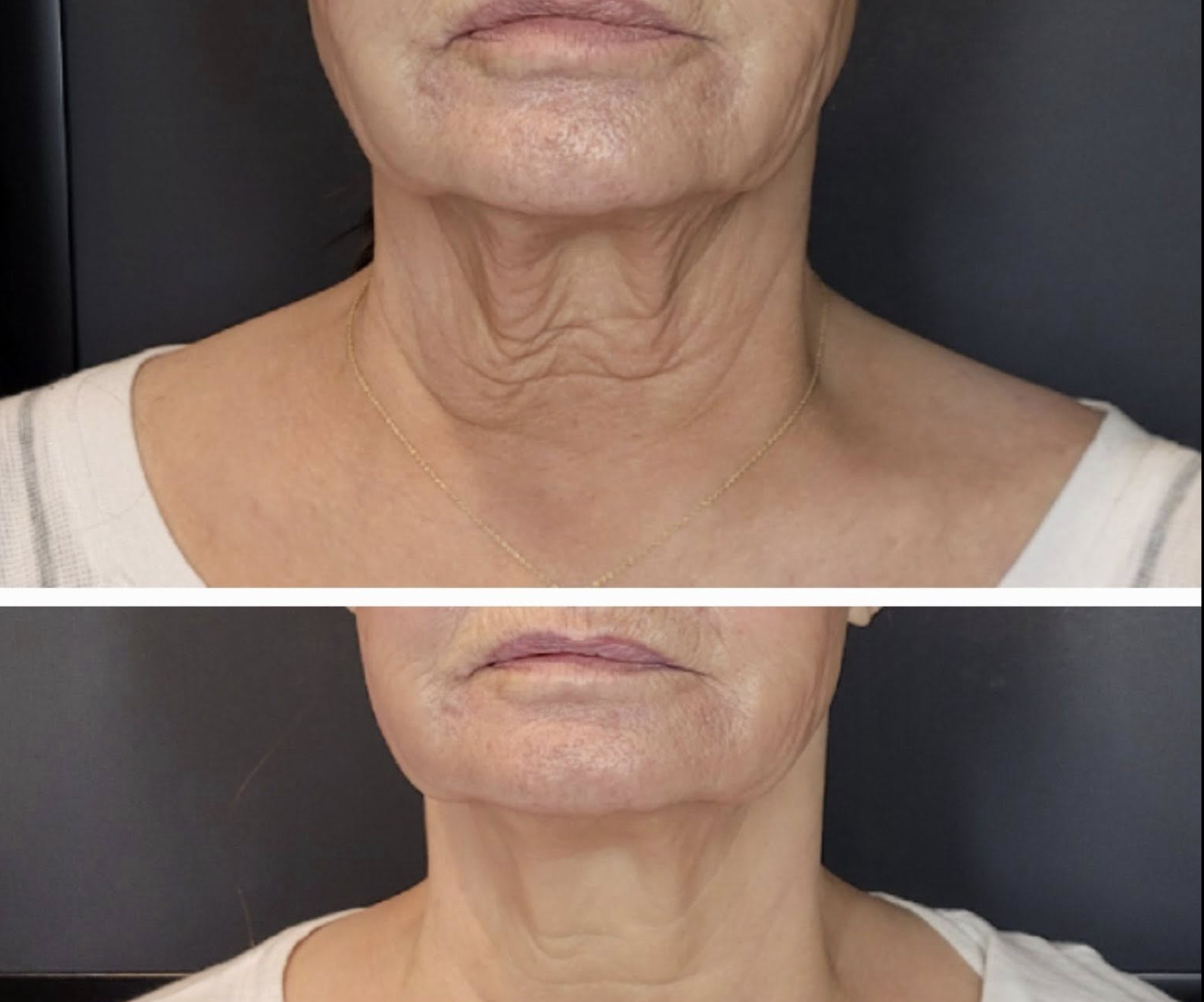 Esthetics transformation
