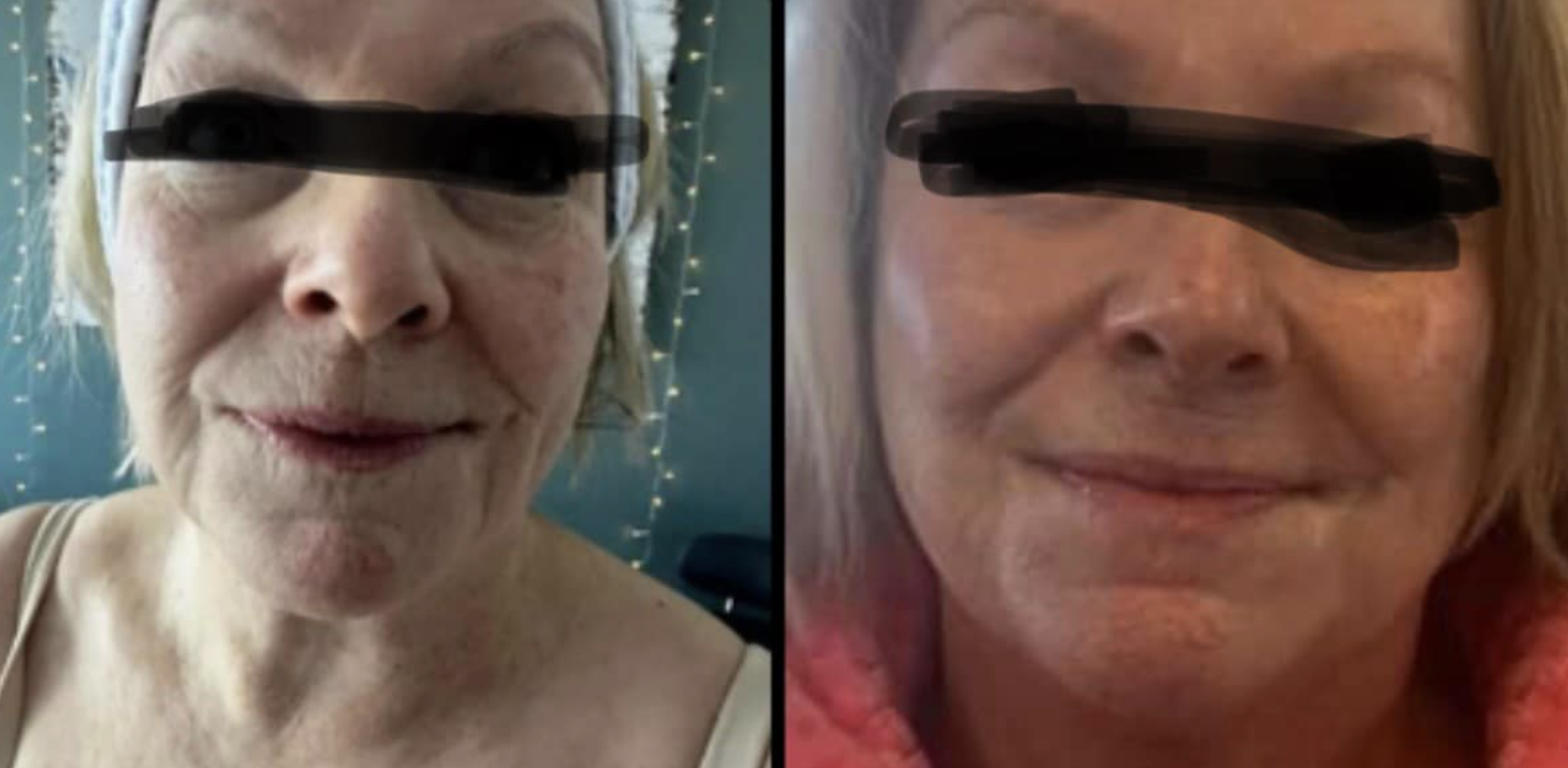 Before and after skincare results