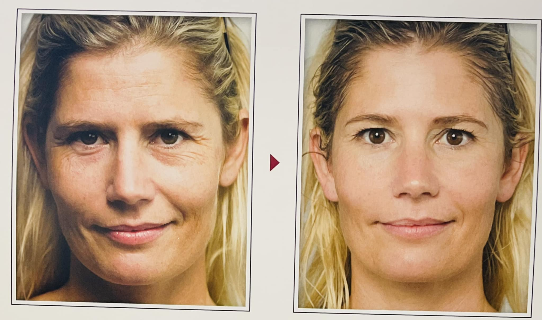 Skincare before and after