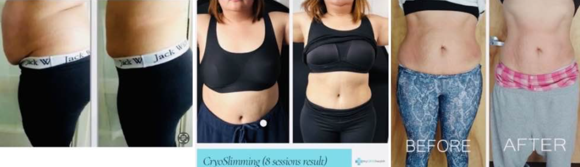 Treatment results