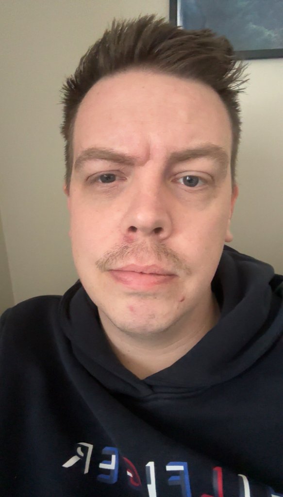 Espen Brekke