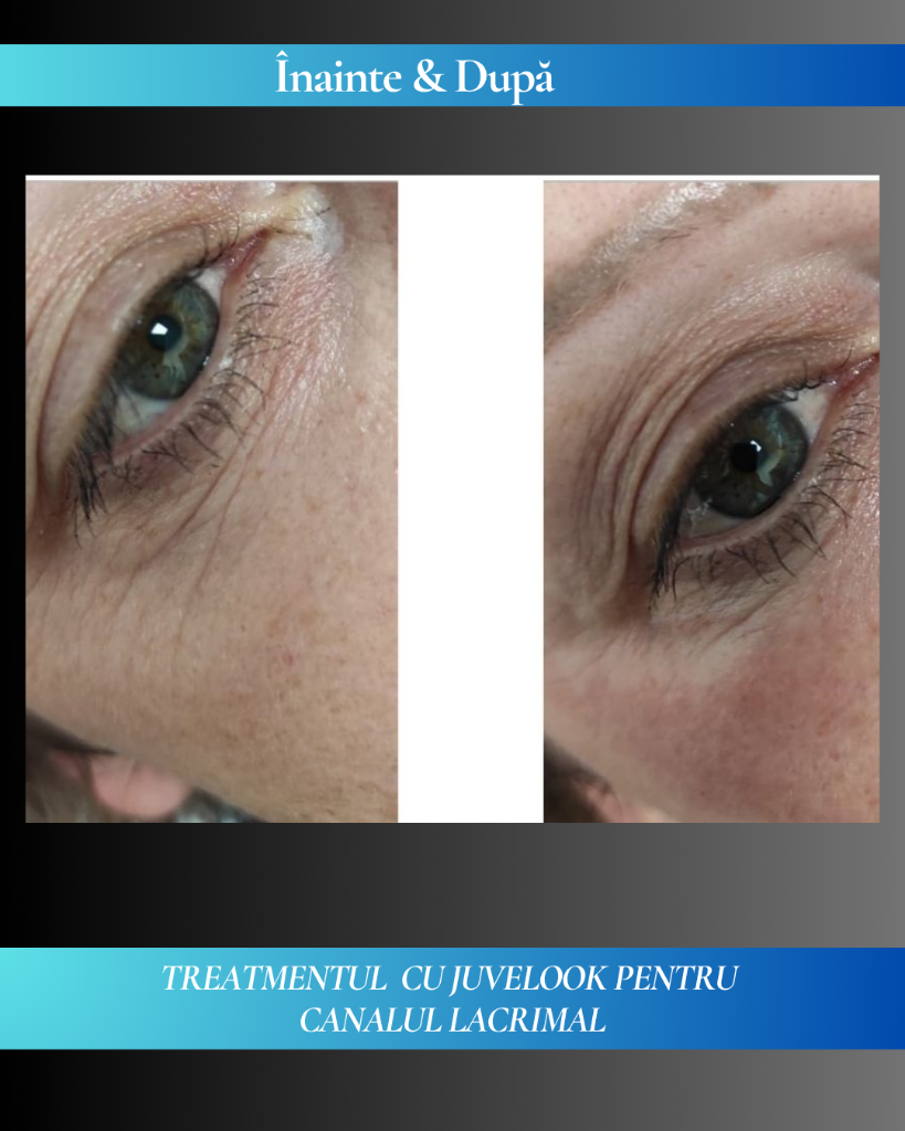 Rezultat clinic JuveLook 9