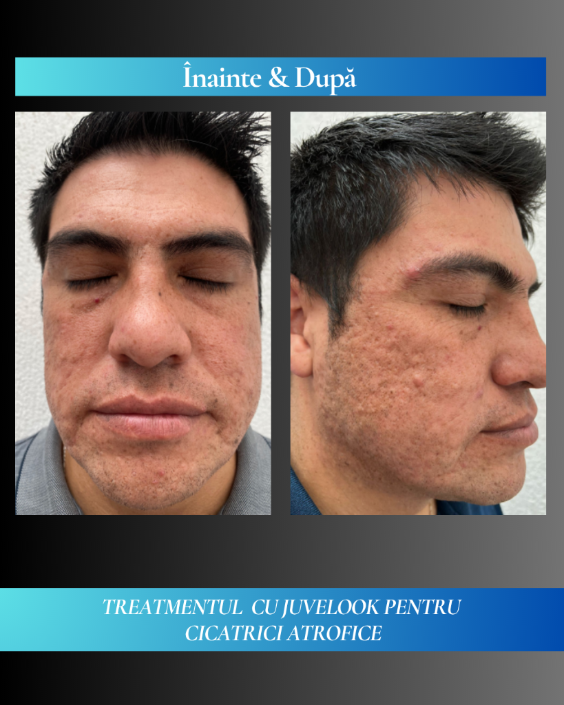 Rezultat clinic JuveLook 2