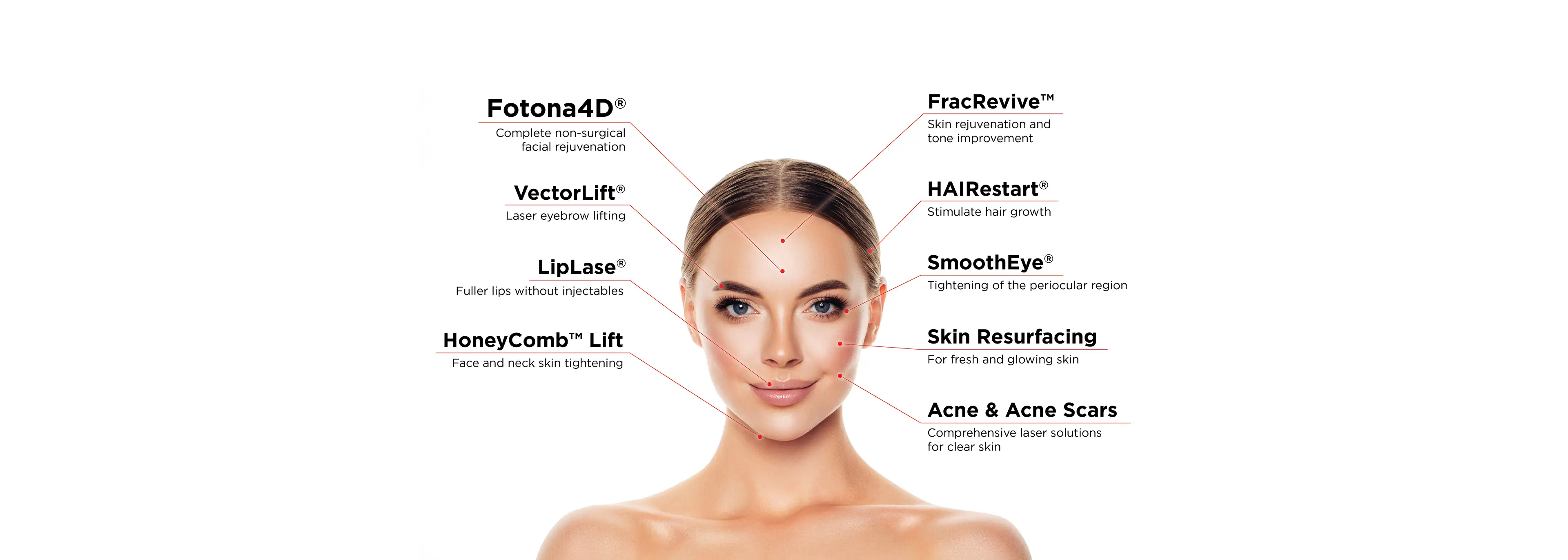 Soluții laser faciale Fotona — Fotona4D, VectorLift, LipLase și altele