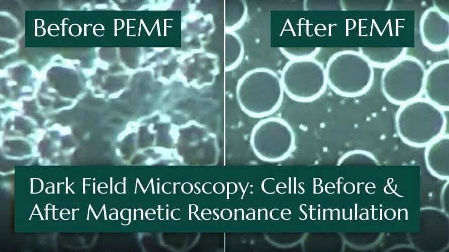 Dark field microscopy: cells before and after magnetic resonance stimulation