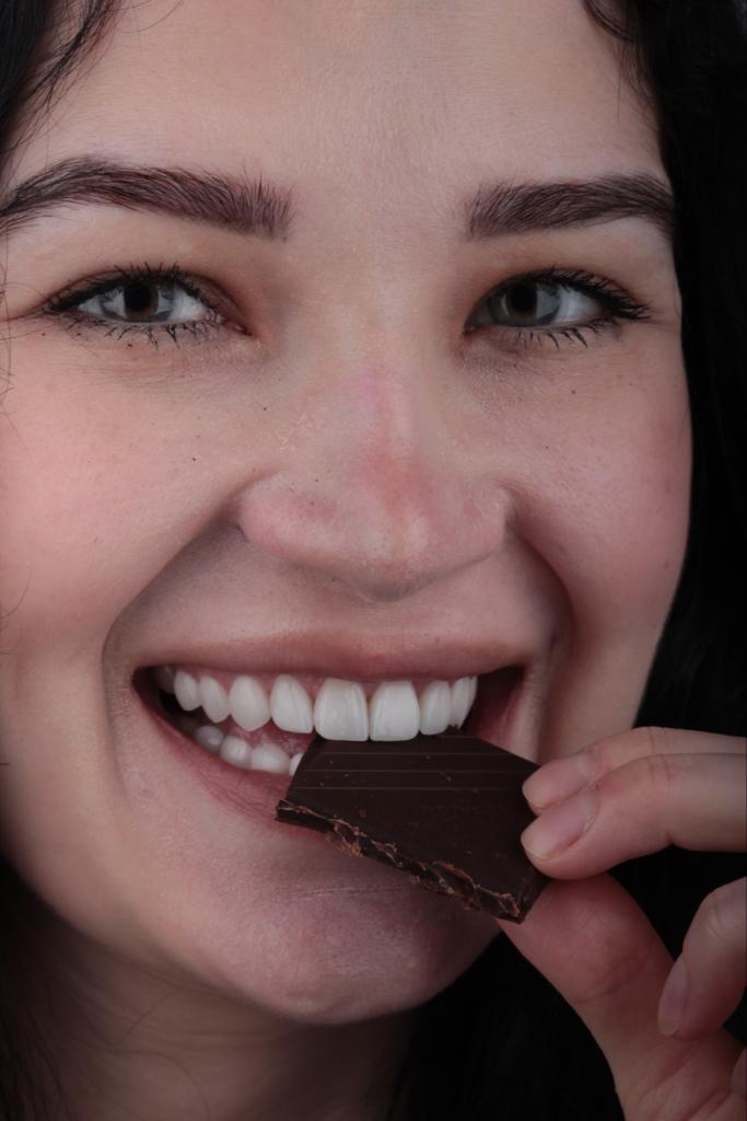 Smile After Veneers