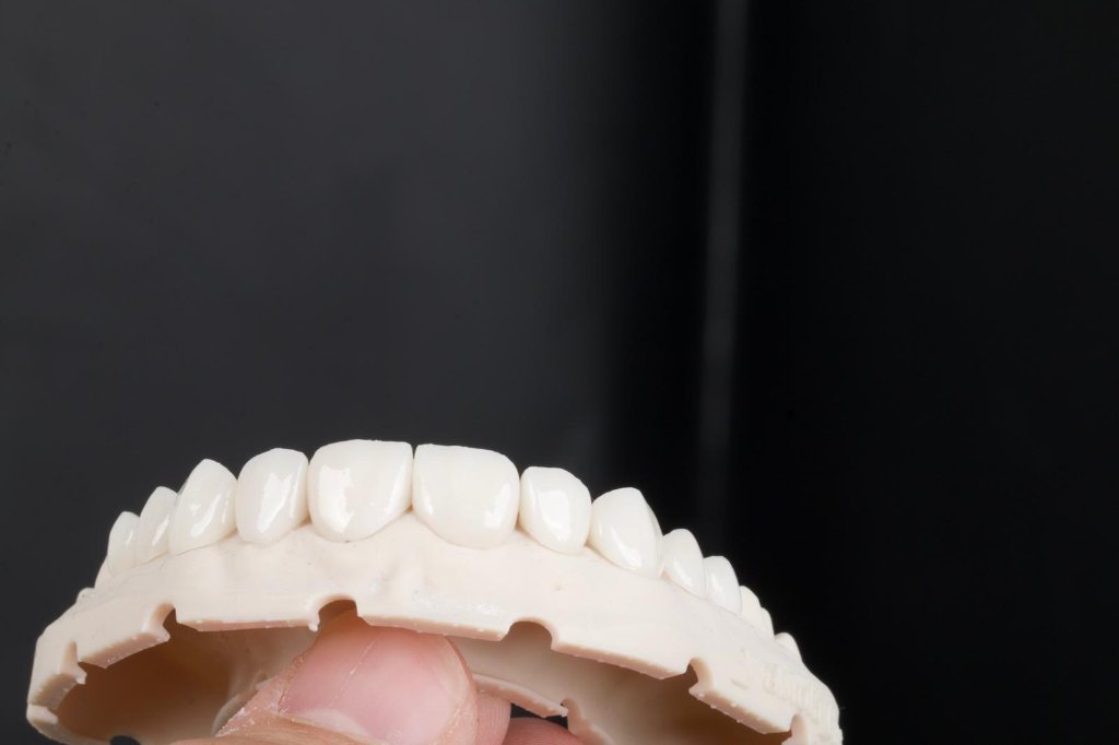 Zirconia Arch — Lab View