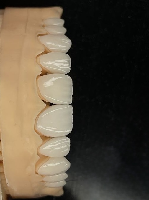 Precision dental lab work