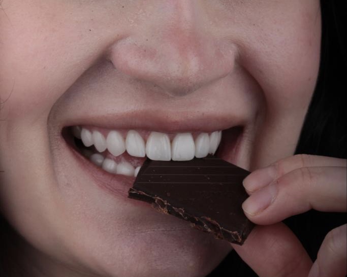 Veneers in Action