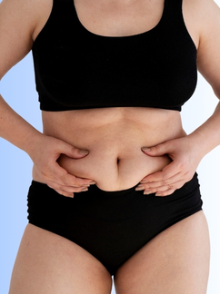 Tummy Tuck
