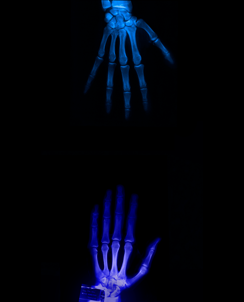 The Touching of the Void