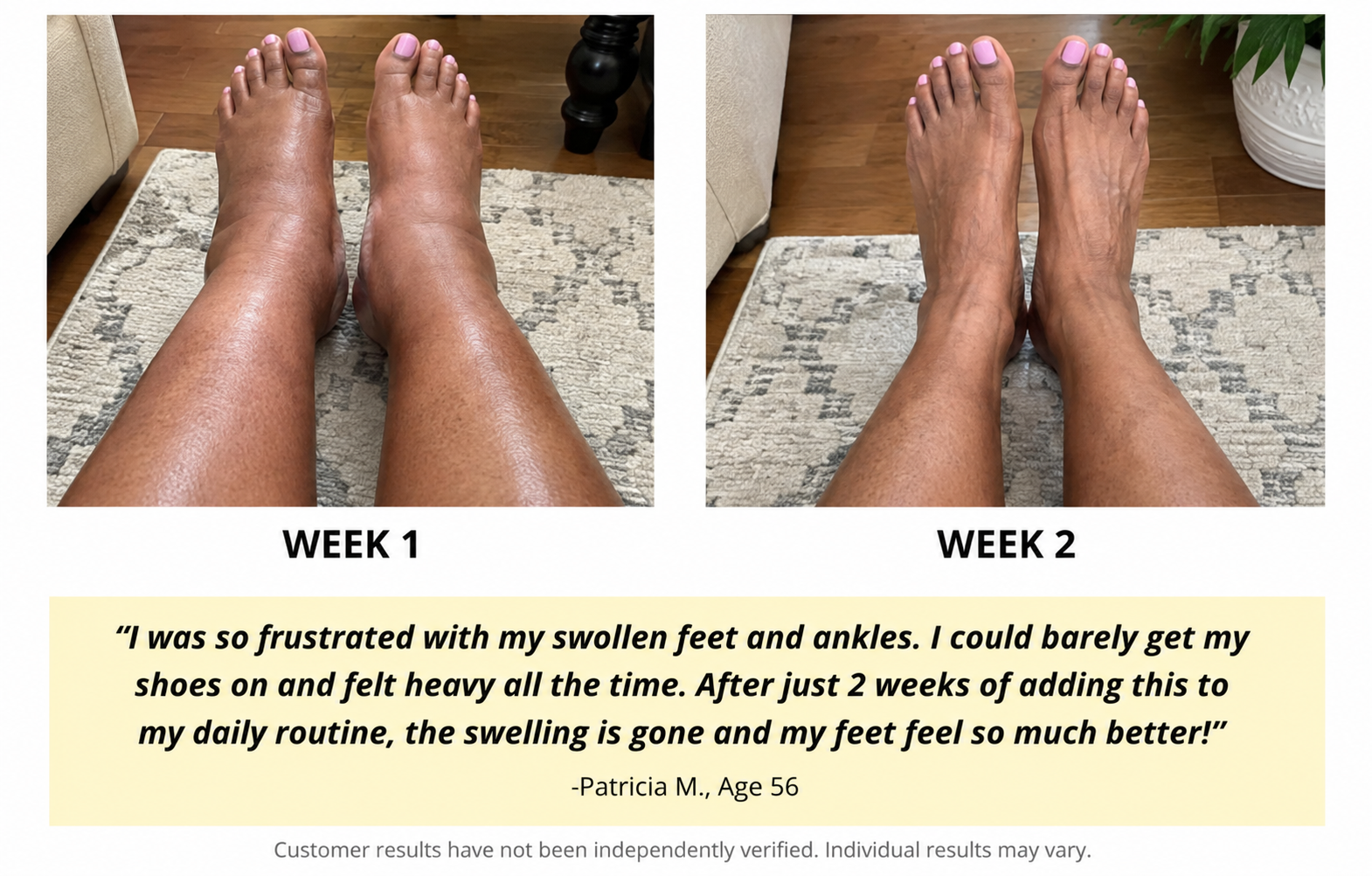 Before and after comparison of swollen feet at week 1 and reduced swelling at week 2, with a testimonial from Patricia M., Age 56
