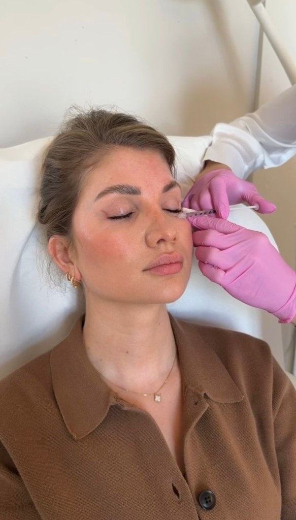 PRP-Behandlung – Hautverjüngung mit plättchenreichem Plasma in Berlin bei Dr. Buschmann