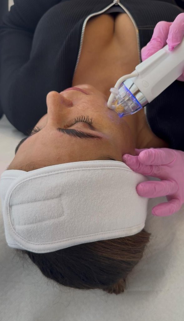 Radiofrequenz Needling in Berlin bei Dr. Buschmann