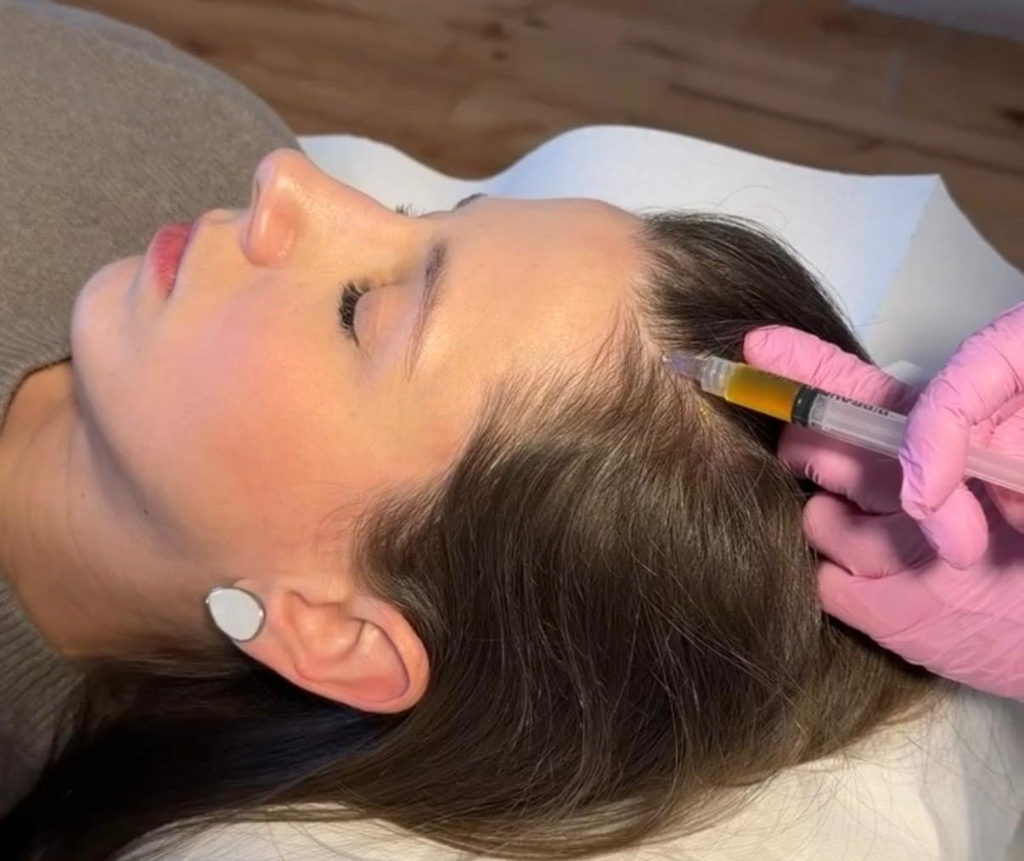 Haarwachstum fördern mit PRP (Eigenbluttherapie) in Berlin bei Dr. Buschmann