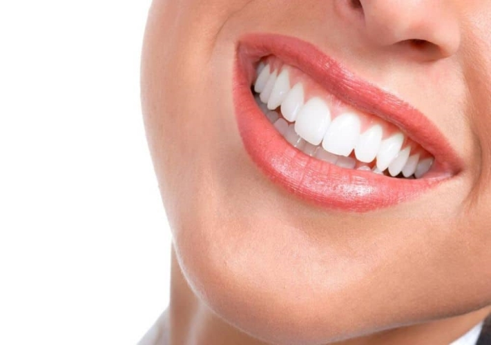 Smile Design