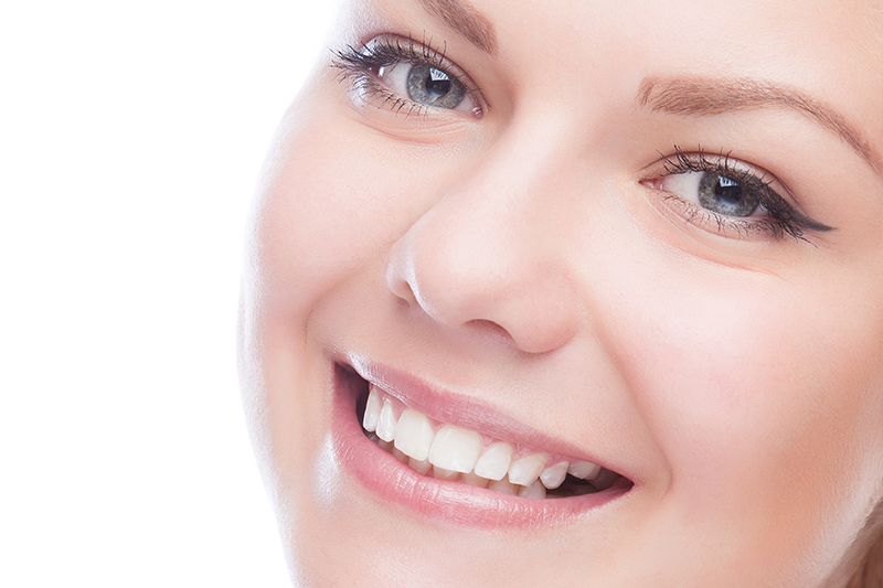 White Fillings