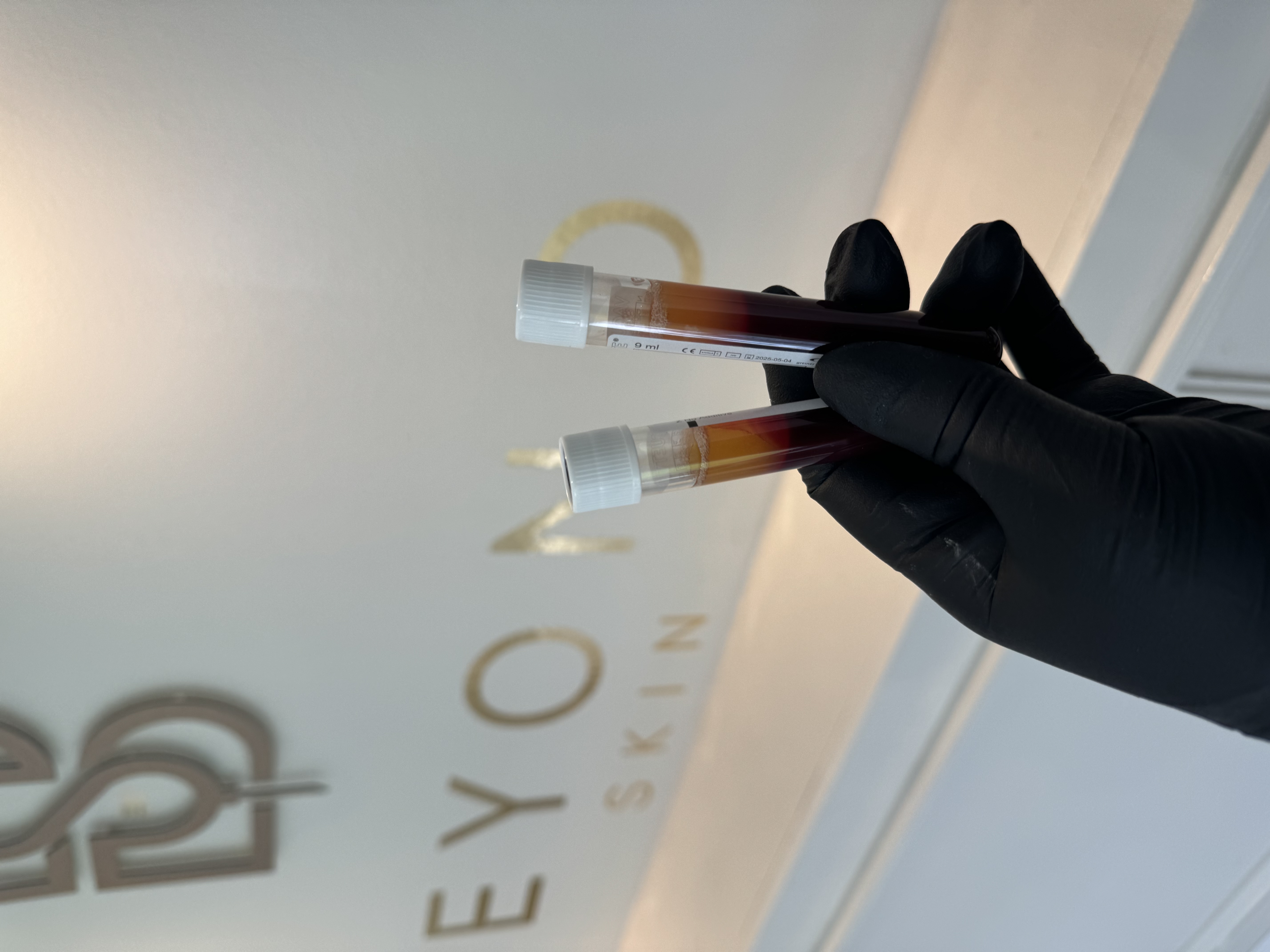 preparation at Beyond Skin UK