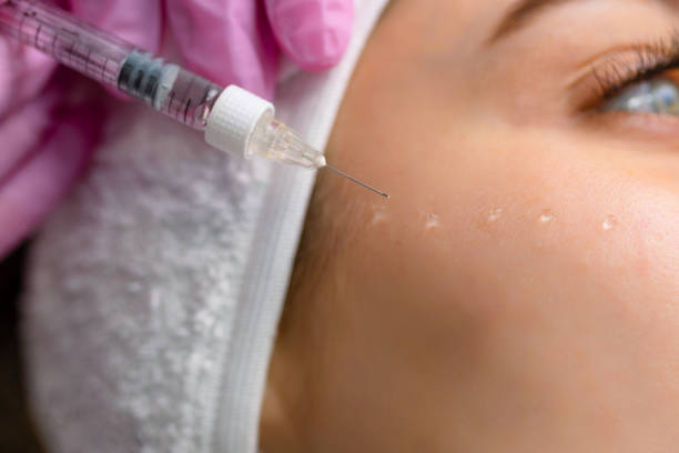 Mesotherapy + Skin Boosters