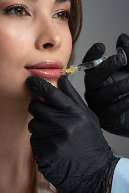 Dermal filler treatment at Beyond Skin UK