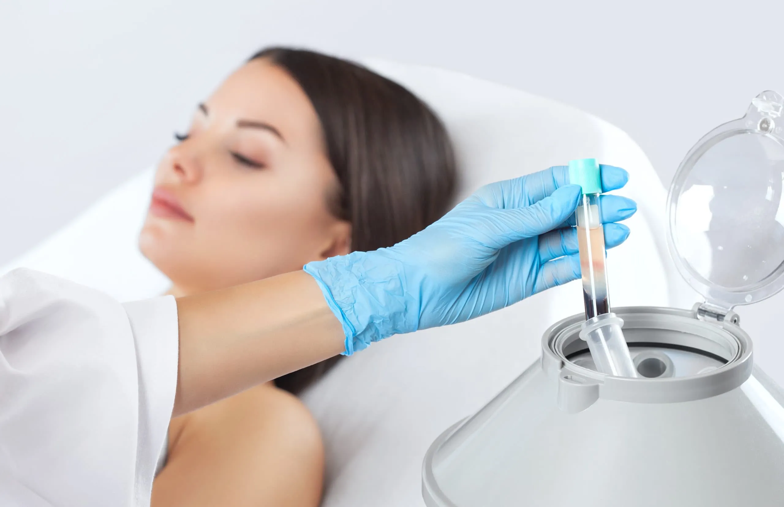 iPRF regenerative treatment at Beyond Skin UK