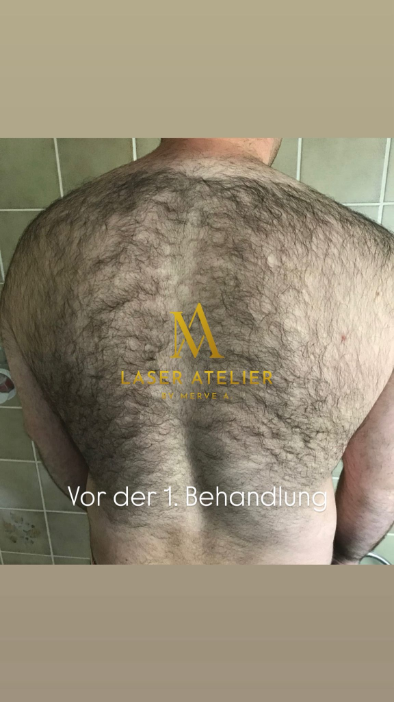Vor der 1. Behandlung