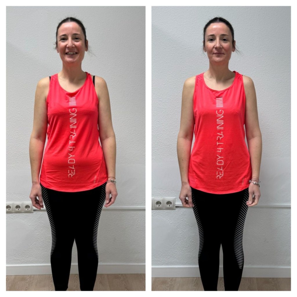 Antes y después de un cliente de Nutrivida Oliveros