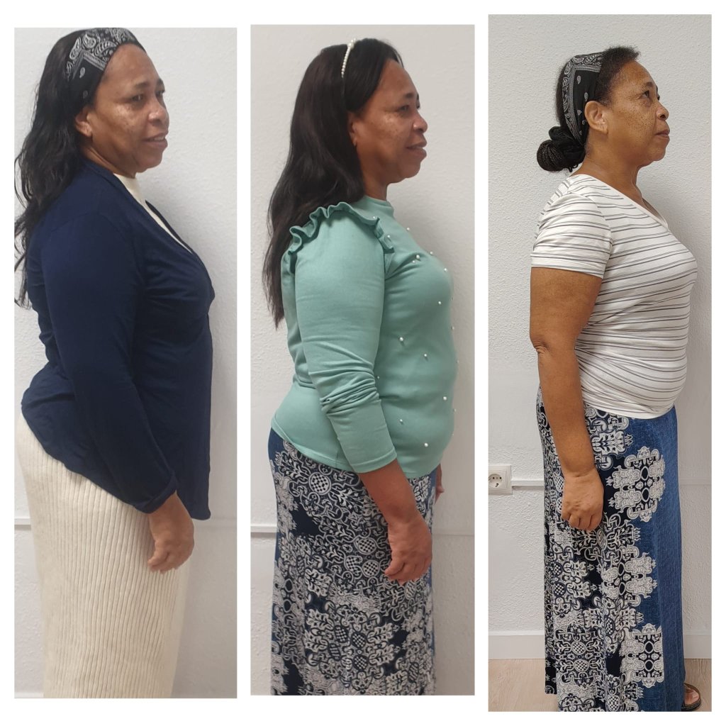 Antes y después de un cliente de Nutrivida Oliveros