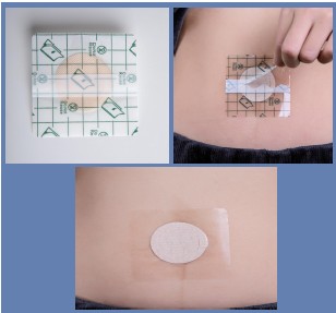 PU Film Water Resistant Wound Patch