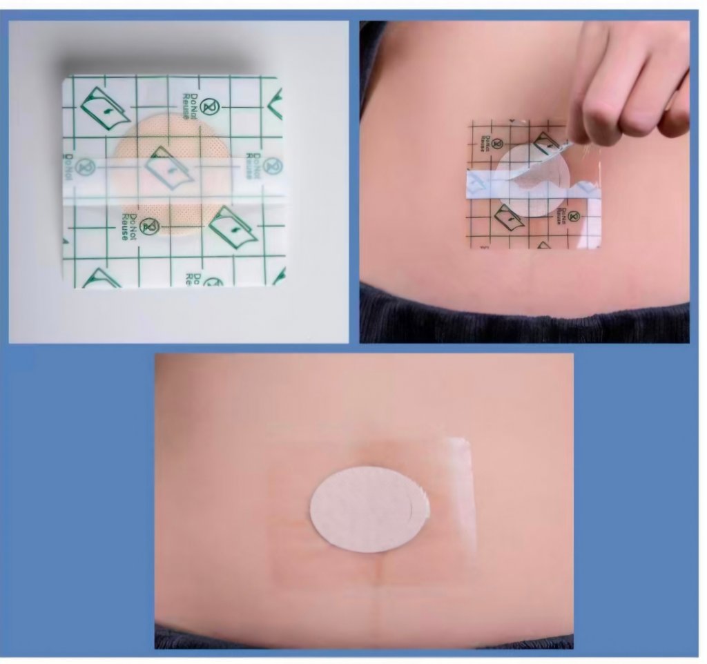 SilSecure Absorbent Composite Dressing