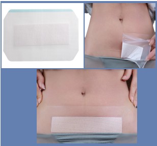 PU Film C-Section Patch