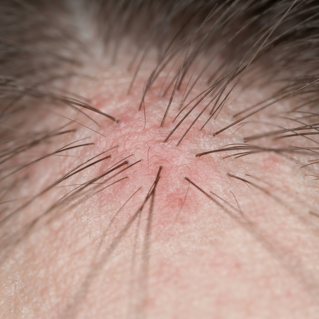 Sensitive-Appearing Scalp — magnified scalp research photograph