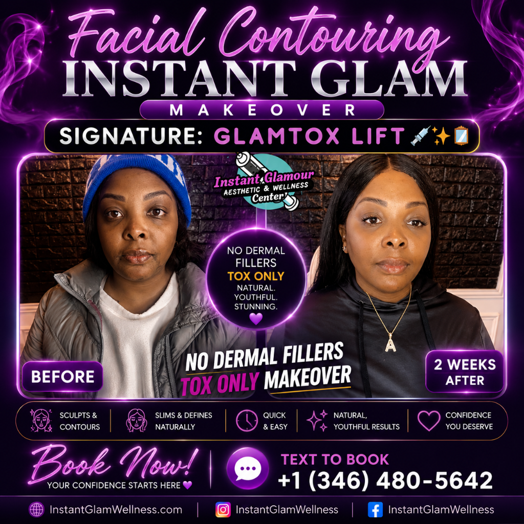 Glamtox Lift — 2 Weeks After, Tox Only