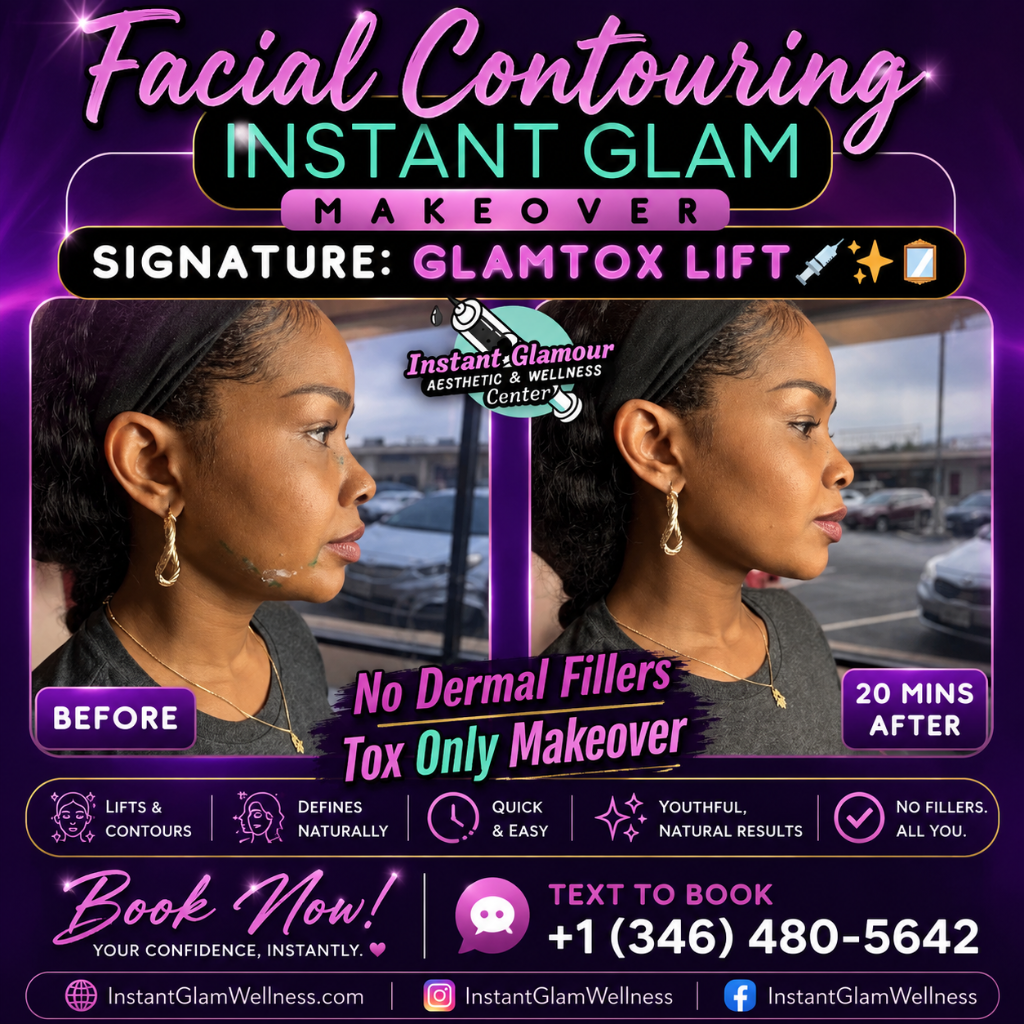 Glamtox Lift — 20 Mins After, No Fillers
