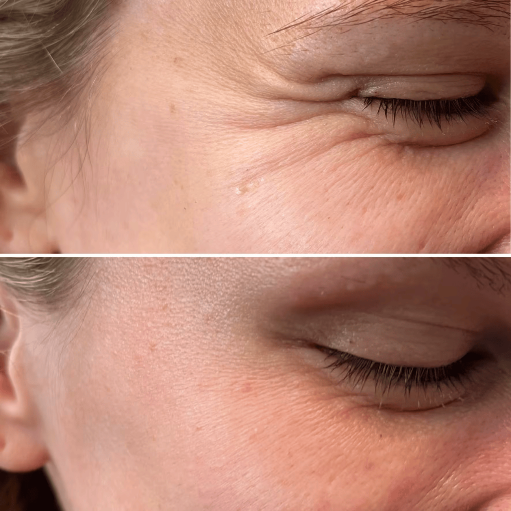 Anti-Wrinkle