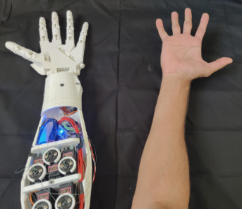 Robotic Hand Prosthetic Controlled by a Glove With Flex Sensors view 2