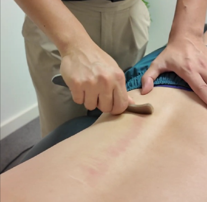 Myofascial Techniques