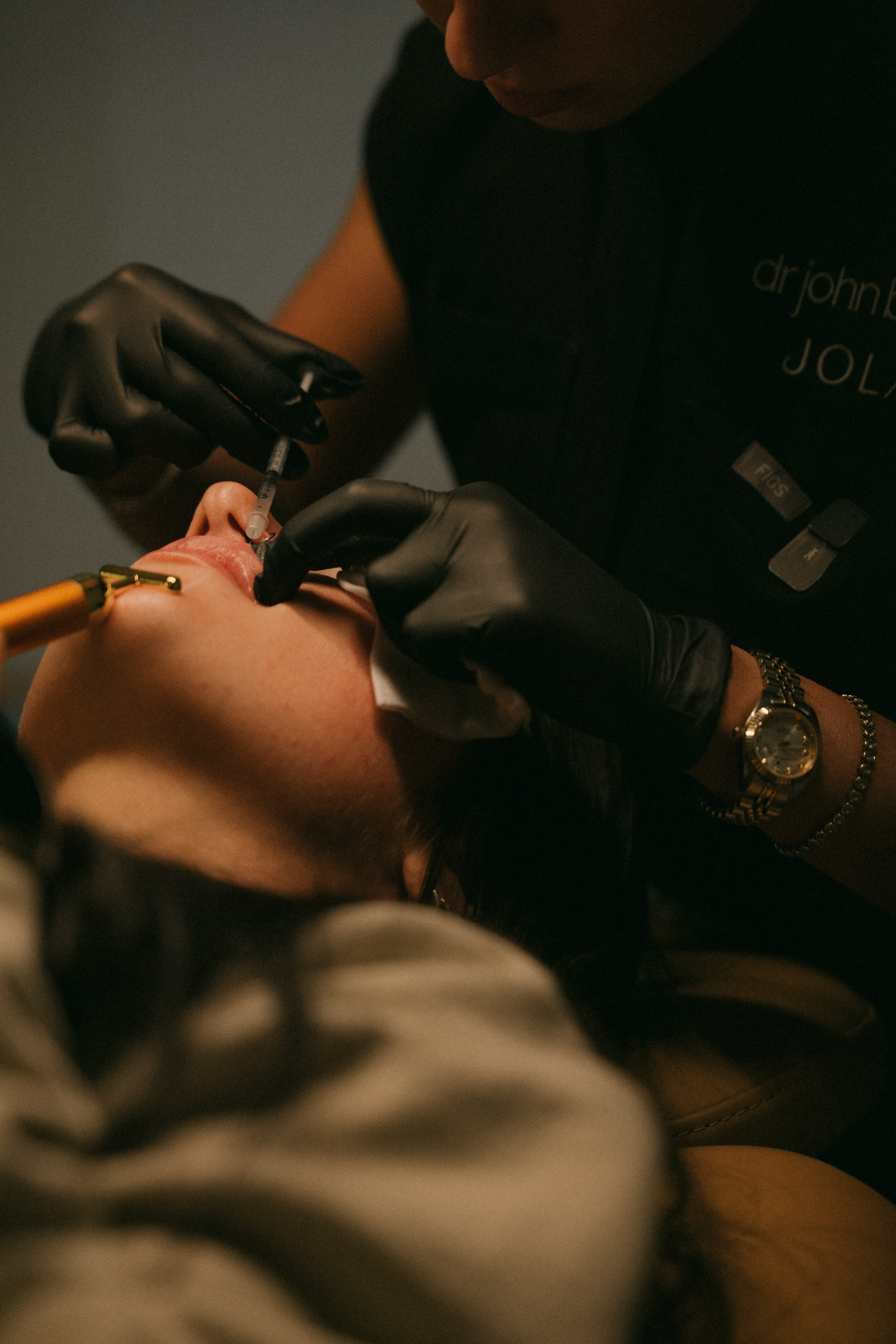 ULTRA Laser for Acne Marks & Acne Scars | JOLA Dallas