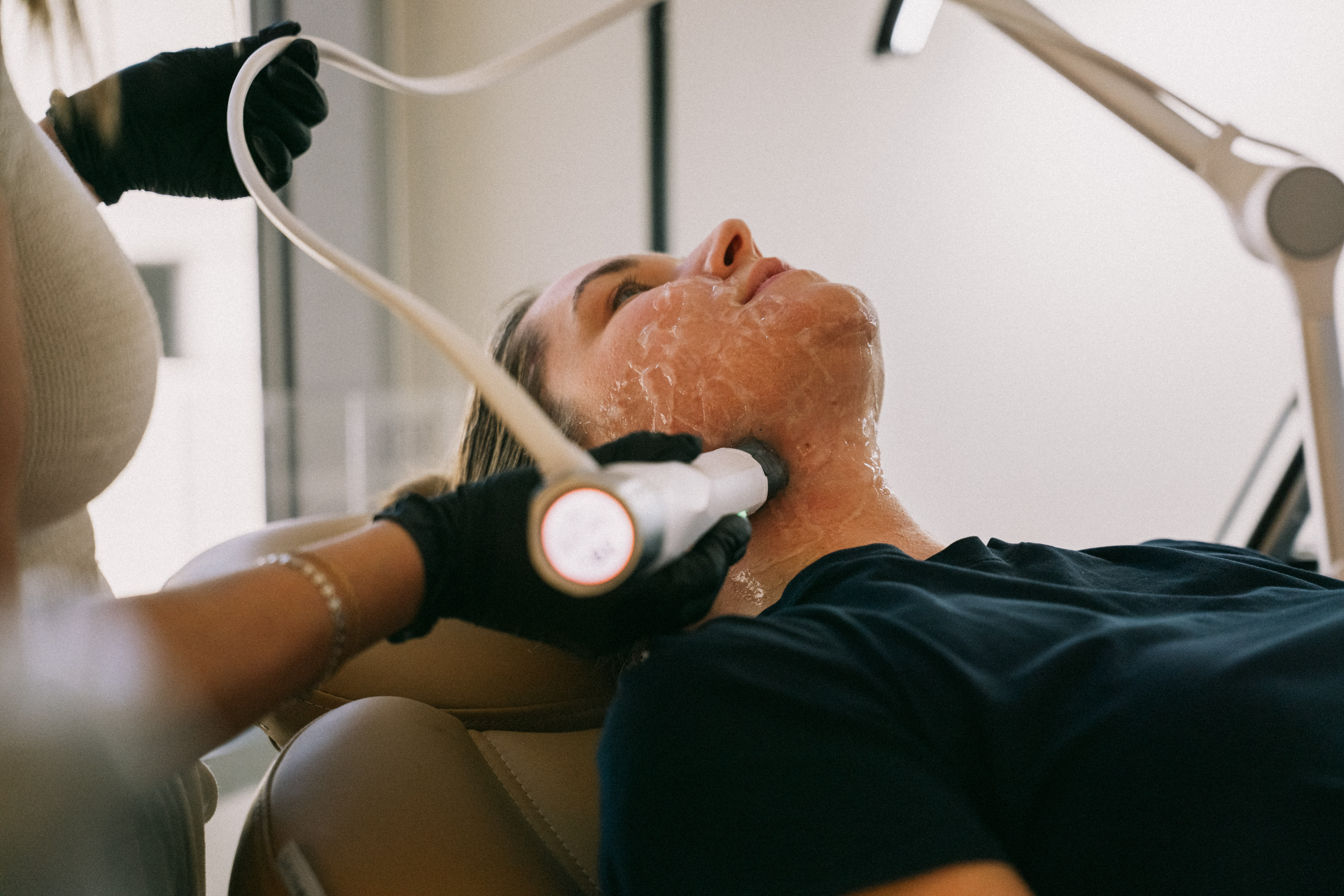 ULTRA vs. Fraxel: Which Laser Is Better for Pigment, Texture & Resurfacing?
