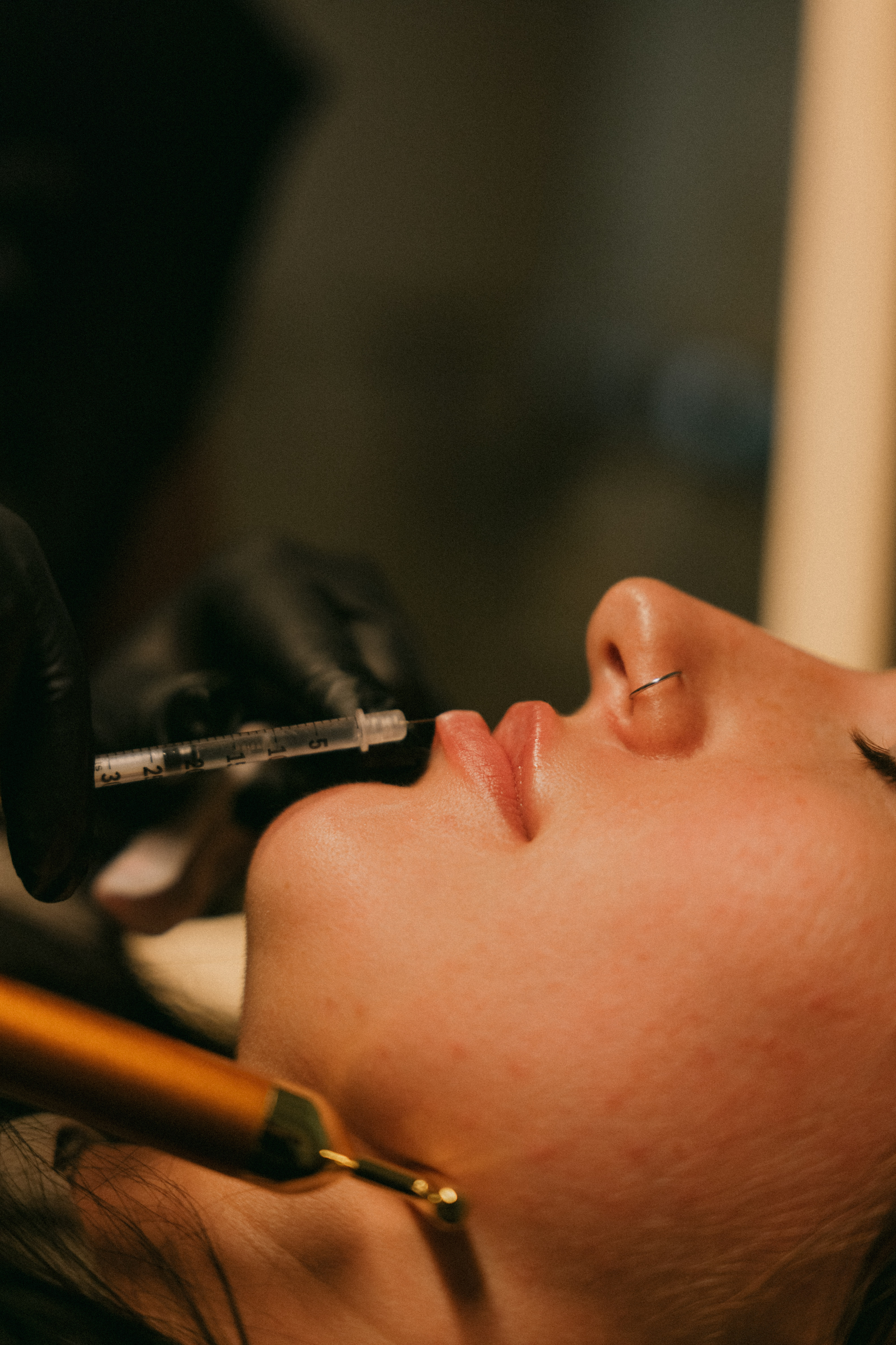XERF vs. Sofwave: Which Skin-Tightening Treatment Is Better?