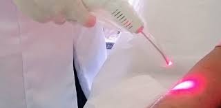 Laserterapia