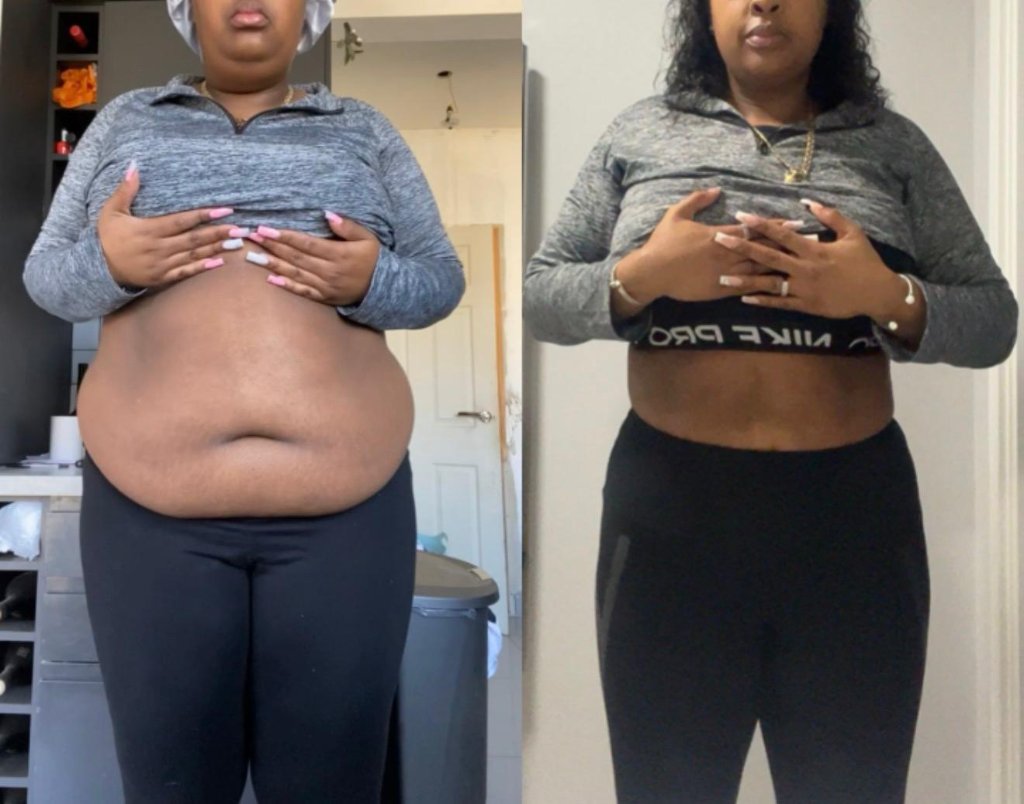 Tia before and after