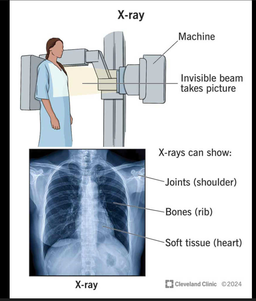 X-ray