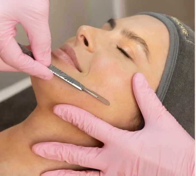 Dermaplaning