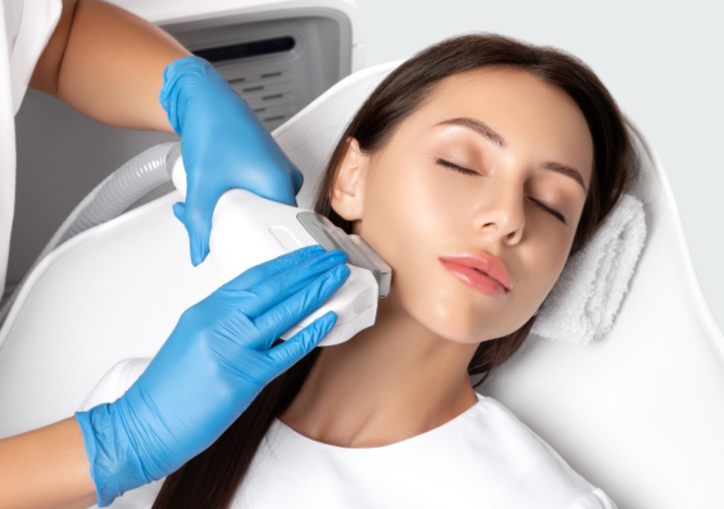 IPL Photofacial