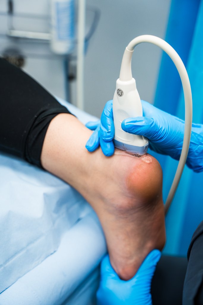 Diagnostic ultrasound